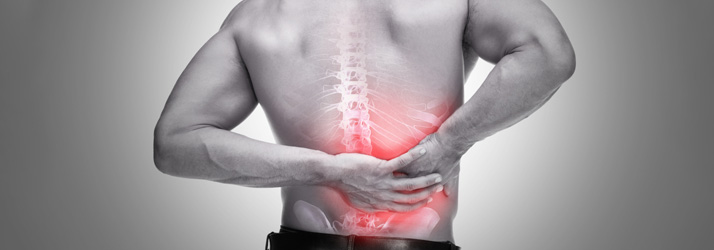 Chiropractic Southeast FL Xray Back Pain
