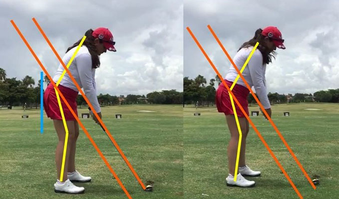 Chiropractor Southeast FL Golf Swing Biomechanics